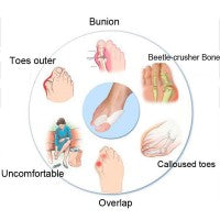 Silky Soft Bunion Relief Toe Sleeves