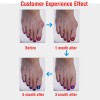 Silky Soft Bunion Relief Toe Sleeves